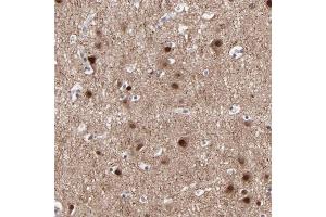Immunohistochemical staining of human cerebral cortex with SIPA1L1 polyclonal antibody  shows strong nuclear positivity in neuronal cells.