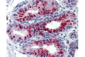 anti-Potassium Channel, Subfamily K, Member 9 (KCNK9) (N-Term) antibody