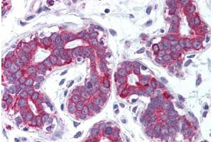 Human Breast (formalin-fixed, paraffin-embedded) stained with TNFSF11 antibody ABIN214007 at 5 ug/ml followed by biotinylated goat anti-rabbit IgG secondary antibody ABIN481713, alkaline phosphatase-streptavidin and chromogen. (RANKL anticorps  (Internal Region))