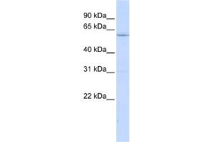WB Suggested Anti-LRRC15 Antibody Titration:  0.