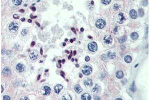 Human Testis: Formalin-Fixed, Paraffin-Embedded (FFPE) (PRDM9 anticorps  (AA 431-480))