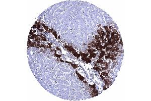 Glutamine Synthetase staining is strong in centrilobular hepatocytes weak to moderate in Kupffer cells but absent in periportal hepatocytes