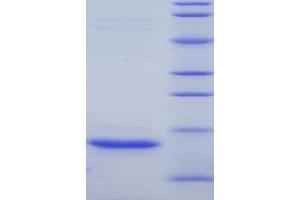 SDS-PAGE (SDS) image for Myoglobin (MB) (AA 1-154) protein (His tag) (ABIN1080352)