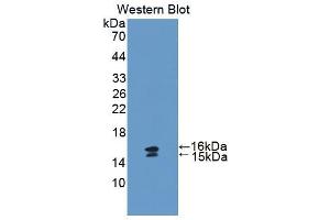 Western blot analysis of the recombinant protein. (Vip anticorps  (AA 34-157))