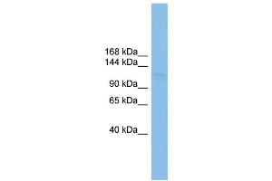 WB Suggested Anti-SF3B3 Antibody Titration: 0. (SF3B3 anticorps  (Middle Region))