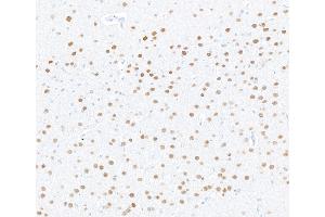 Immunohistochemistry (IHC) image for anti-Myocyte Enhancer Factor 2C (MEF2C) (AA 425-475) antibody (ABIN7795747) (Recombinant MEF2C anticorps  (AA 425-475))