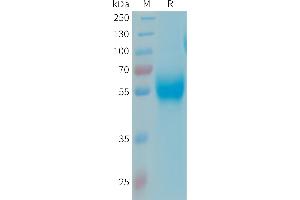Human APOH Protein, His Tag on SDS-PAGE under reducing condition.