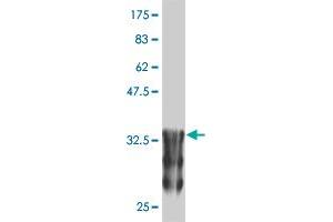 Western Blot detection against Immunogen (37. (ANKRD17 anticorps  (AA 2501-2603))
