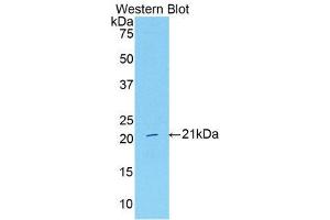 Western Blotting (WB) image for anti-Serpin Peptidase Inhibitor, Clade G (C1 Inhibitor), Member 1 (SERPING1) (AA 35-179) antibody (ABIN3208986) (SERPING1 anticorps  (AA 35-179))