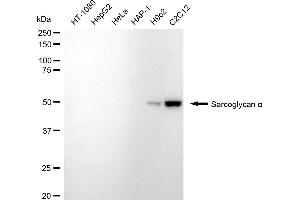 Western blotting analysis using Sarcoglycan alpha antibody (ABIN7800271).