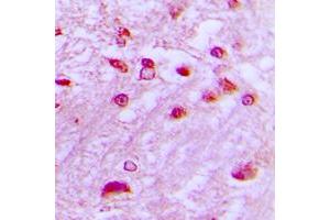 Immunohistochemical analysis of DYRK1A staining in human brain formalin fixed paraffin embedded tissue section.