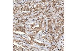 IHC analysis of U1A/SNRPA using anti-U1A/SNRPA antibody (ABIN7600891). (SNRPA1 anticorps  (AA 25-218))