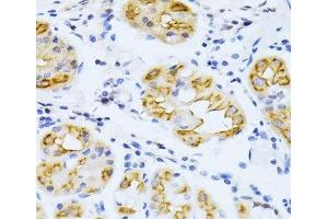 Immunohistochemistry of paraffin-embedded Human stomach using CYP2E1 Polyclonal Antibody at dilution of 1:100 (40x lens). (CYP2E1 anticorps)