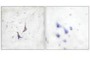 Immunohistochemistry analysis of paraffin-embedded human brain tissue using Syndecan4 (Ab-179) antibody. (SDC4 anticorps  (Ser179))