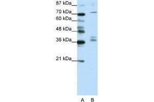 WB Suggested Anti-AKAP9 Antibody Titration:  1.
