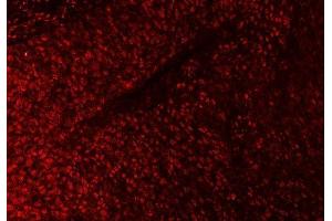 IF analysis of SAP18 using anti-SAP18 antibody (ABIN7599009). (SAP18 anticorps  (AA 1-153))