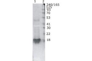 anti-Hev b1 antibody