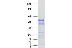 Validation with Western Blot