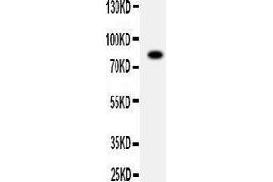 Anti-ADAM2 antibody, Western blotting WB: SMMC Cell Lysate (ADAM2 anticorps  (C-Term))