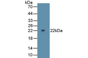 Detection of Recombinant MMP9, Bovine using Monoclonal Antibody to Matrix Metalloproteinase 9 (MMP9)