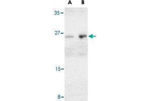 Western blot analysis of BCAP29 in human heart tissue lysate with BCAP29 polyclonal antibody  at (A) 1 and (B) 2 ug/mL . (BCAP29 anticorps  (Internal Region))