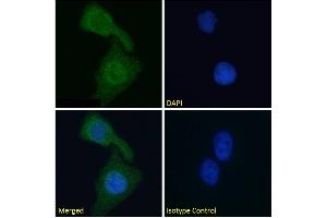 Immunofluorescence staining of fixed HeLa cells with anti-Cardiac Troponin I antibody scFv 180. (Recombinant TNNI3 anticorps)