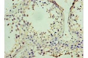 Immunohistochemistry of paraffin-embedded human testis tissue using ABIN7169001 at dilution of 1:100 (STK38 anticorps  (AA 1-200))