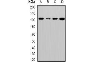 Western blot analysis of Sec5 expression in MCF7 (A), Hela (B), mouse lung (C), rat brain (D) whole cell lysates. (EXOC2 anticorps)