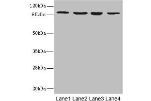 Western blot All lanes: ITGB7 antibody at 5. (Integrin beta 7 anticorps  (AA 1-140))