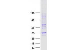 Validation with Western Blot