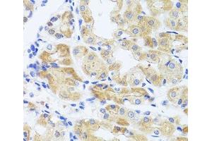 Immunohistochemistry of paraffin-embedded Human stomach using INADL Polyclonal Antibody at dilution of 1:100 (40x lens). (PATJ anticorps)