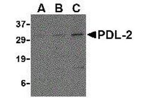 Western Blotting (WB) image for anti-Programmed Cell Death 1 Ligand 2 (PDCD1LG2) (Center) antibody (ABIN2479600) (PDCD1LG2 anticorps  (Center))