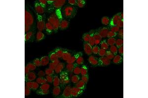Immunofluorescence Analysis of Human MCF-7 cells labeling RCAS1 with RCAS1 Mouse Monoclonal Antibody (CPTC-EBAG9-1) followed by Goat anti-Mouse IgG-CF488 (Green).