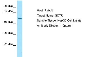 Western Blotting (WB) image for anti-Secretin Receptor (SCTR) (N-Term) antibody (ABIN2790165) (SCTR anticorps  (N-Term))