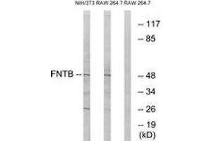 Western blot analysis of extracts from RAW264. (FNTB anticorps  (AA 255-304))