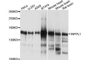 Western blot analysis of extracts of various cells, using INPPL1 antibody. (INPPL1 anticorps)