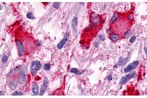 Image no. 2 for anti-G Protein-Coupled Receptor 25 (GPR25) (N-Term) antibody (ABIN1048783)