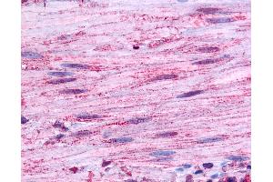Anti-BDKRB1 antibody IHC of human smooth muscle.