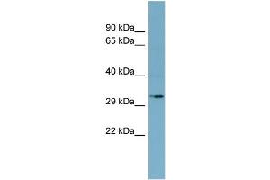 WB Suggested Anti-MGC4172 Antibody Titration:  0. (MGC4172 (Middle Region) anticorps)