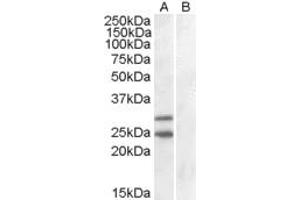 HEK293 overexpressing SOCS1 and probed with ABIN184575 (mock transfection in lane B). (SOCS1 anticorps  (C-Term))