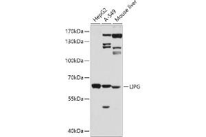 Western blot analysis of extracts of various cell lines, using LIPG antibody (ABIN3015671, ABIN3015672, ABIN3015673 and ABIN6219026) at 1:500 dilution. (LIPG anticorps  (AA 251-500))