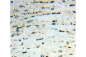 Used in DAB staining on fromalin fixed paraffin-embedded Heart tissue (CCL26 anticorps  (AA 24-94))