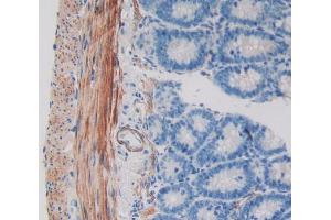 Used in DAB staining on fromalin fixed paraffin- embedded intestine tissue (WIF1 anticorps  (AA 38-247))