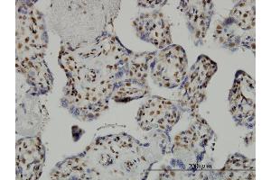 Immunoperoxidase of monoclonal antibody to TAF7 on formalin-fixed paraffin-embedded human placenta. (TAF7 anticorps  (AA 130-224))