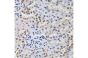 Immunohistochemistry of paraffin-embedded rat kidney using MDM2 Antibody  at dilution of 1:200 (40x lens).