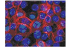 Human epidermal keratinocytes from neonatal foreskin stained in Immunofluorescence with TGM1 antibody Cat. (TGM1 anticorps)
