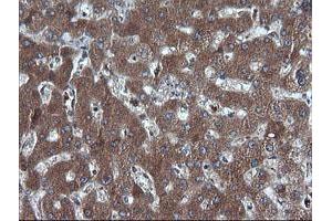 Image no. 3 for anti-DEAD (Asp-Glu-Ala-Asp) Box Polypeptide 58 (DDX58) antibody (ABIN1500708) (DDX58 anticorps)