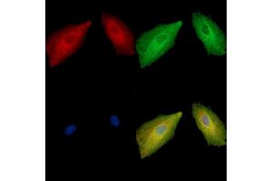ABIN7096929 and ABIN7100995 staining  cells by IF/ICC.