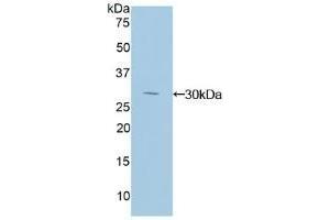 Detection of Recombinant IkBd, Human using Polyclonal Antibody to Inhibitory Subunit Of NF Kappa B Delta (IkBd) (IkBd anticorps  (AA 46-285))