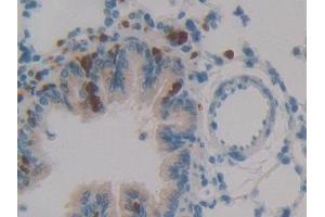 Detection of LEI in Rat Lung Tissue using Polyclonal Antibody to Leukocyte Elastase Inhibitor (LEI)